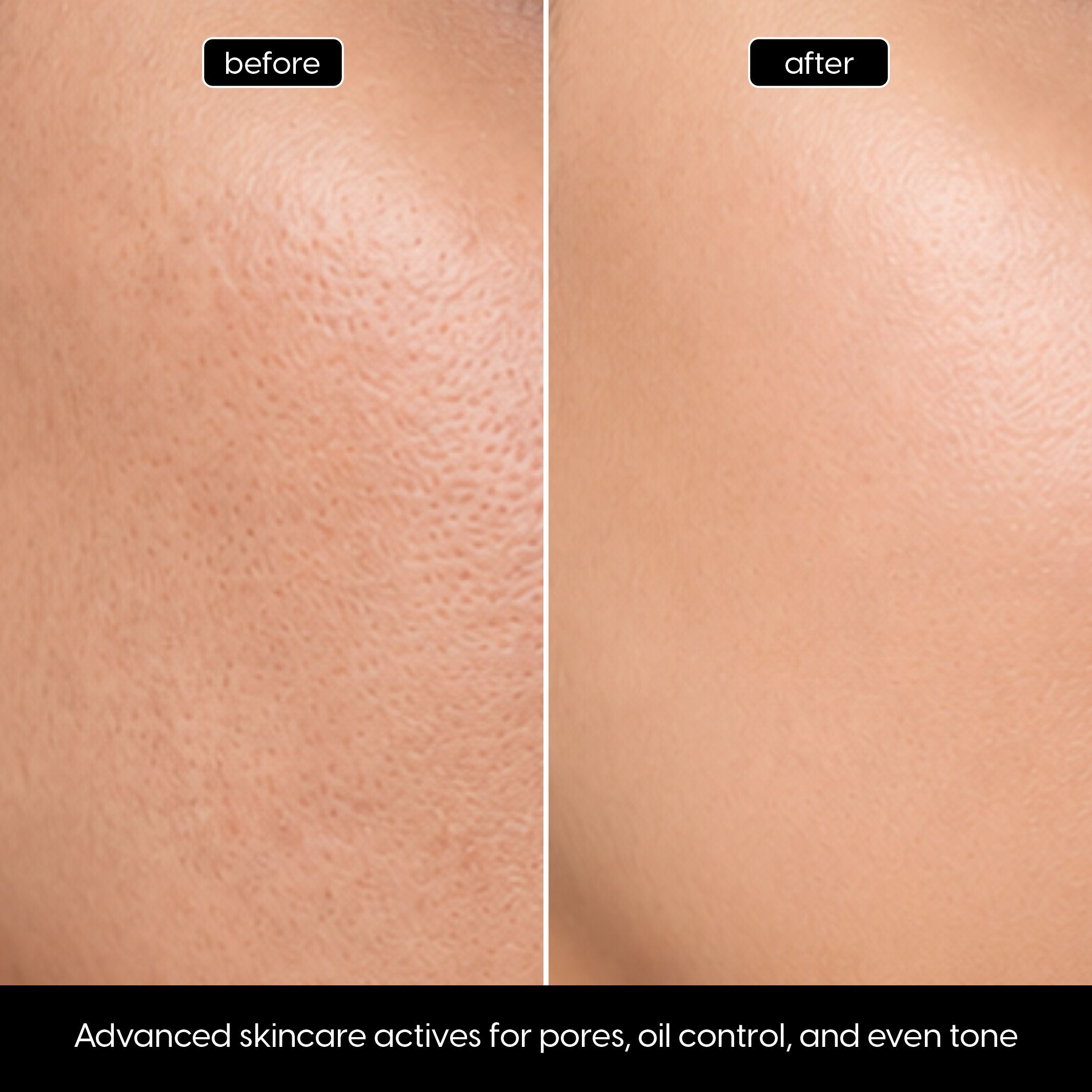 Niacinamide + Zinc Serum for Oil Control & Refined Pores