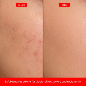 Glycolic Acid 10% Serum for Smooth, Bright, Even-Looking Skin