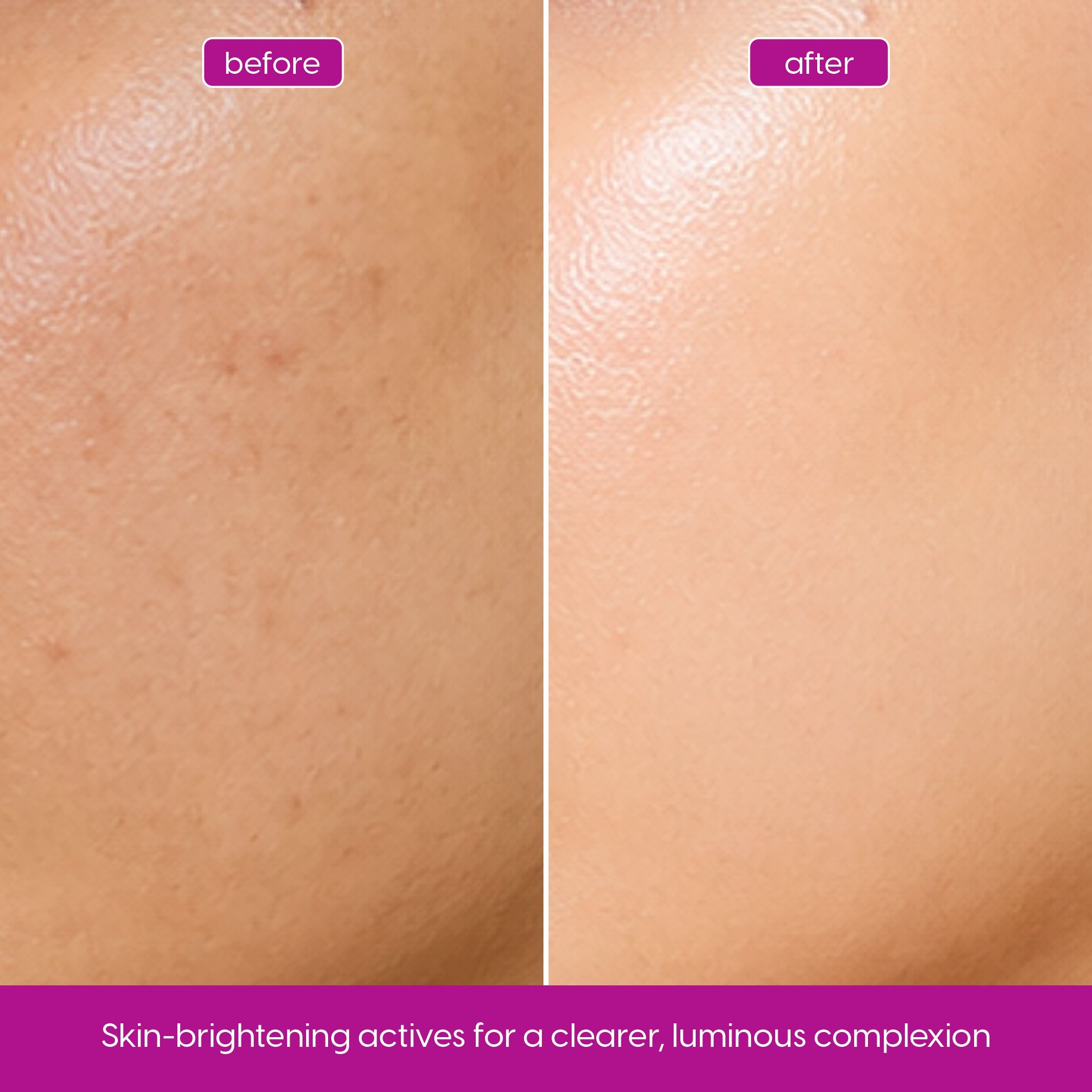 Glutathione Serum for Skin Brightening & a More Even Tone