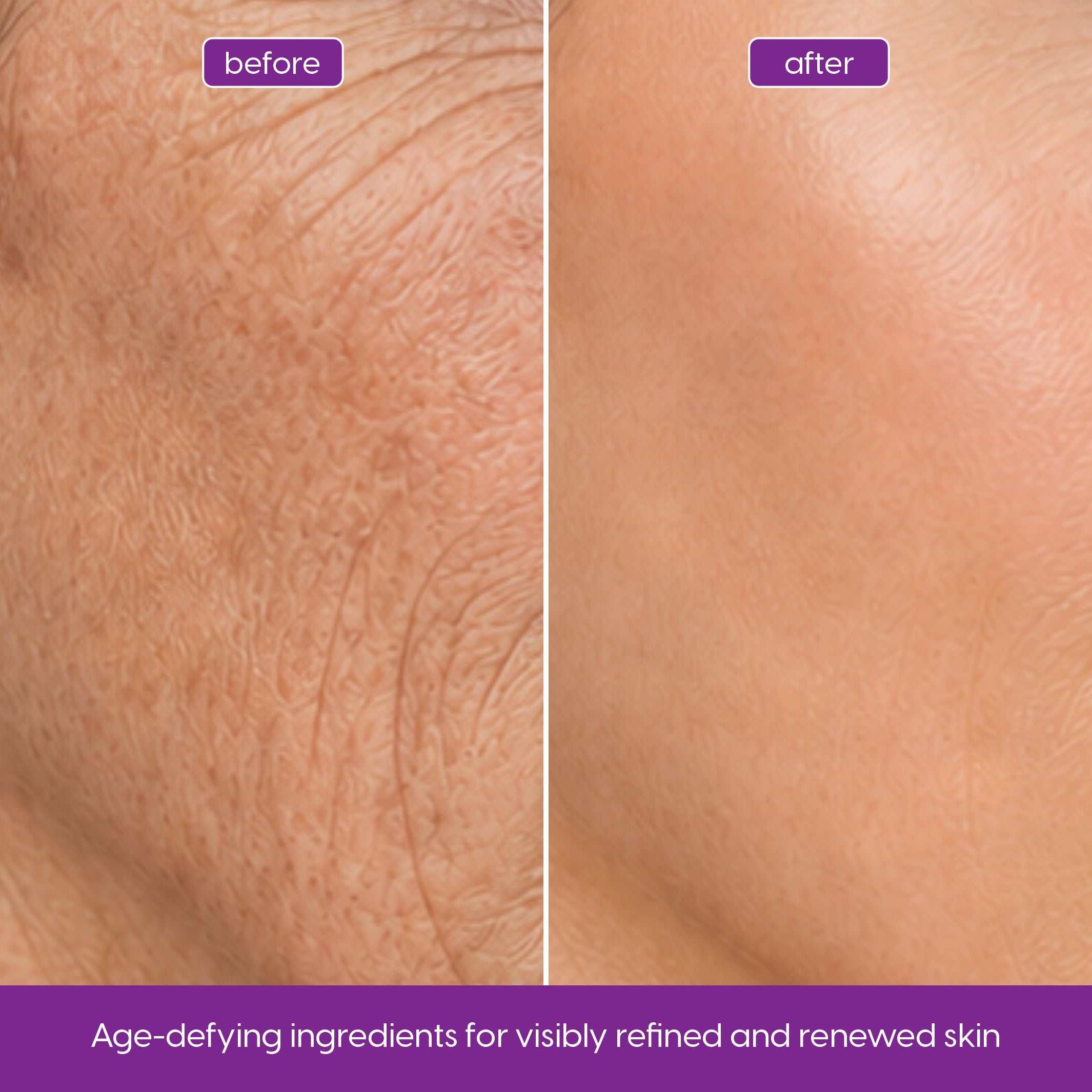 Retinol Serum with Niacinamide for Fine Lines & Smoother Skin