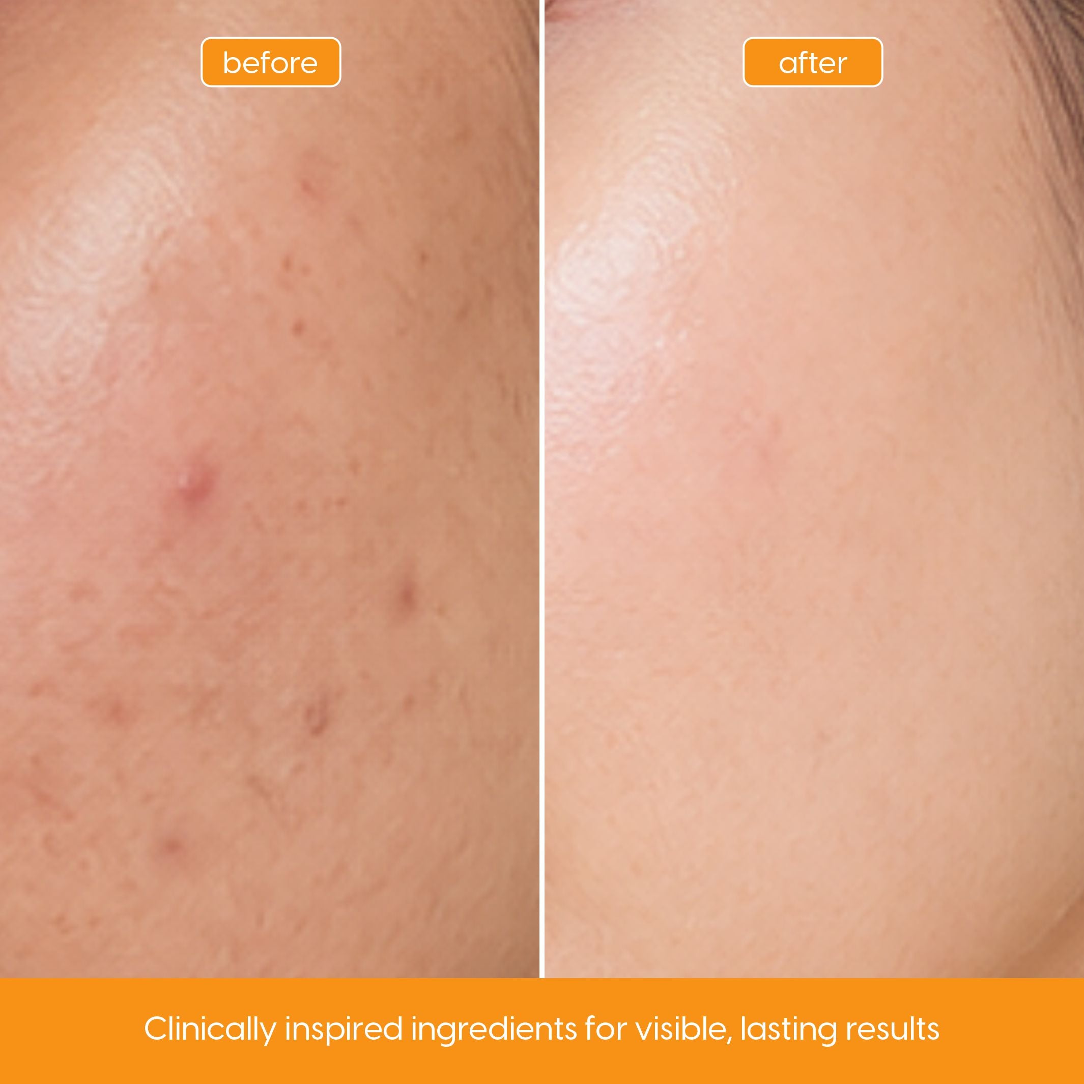 Vitamin C Serum for Brightening, Dark Spots & Uneven Tone
