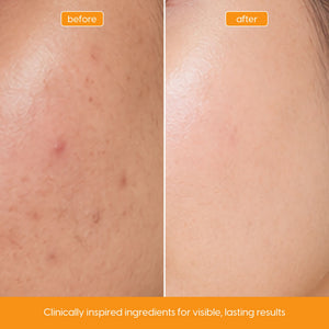 Vitamin C Serum for Brightening, Dark Spots & Uneven Tone