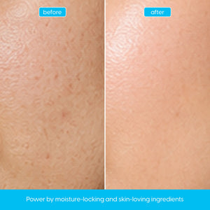 Hyaluronic Acid Serum for Deep Hydration & Plump, Dewy Skin