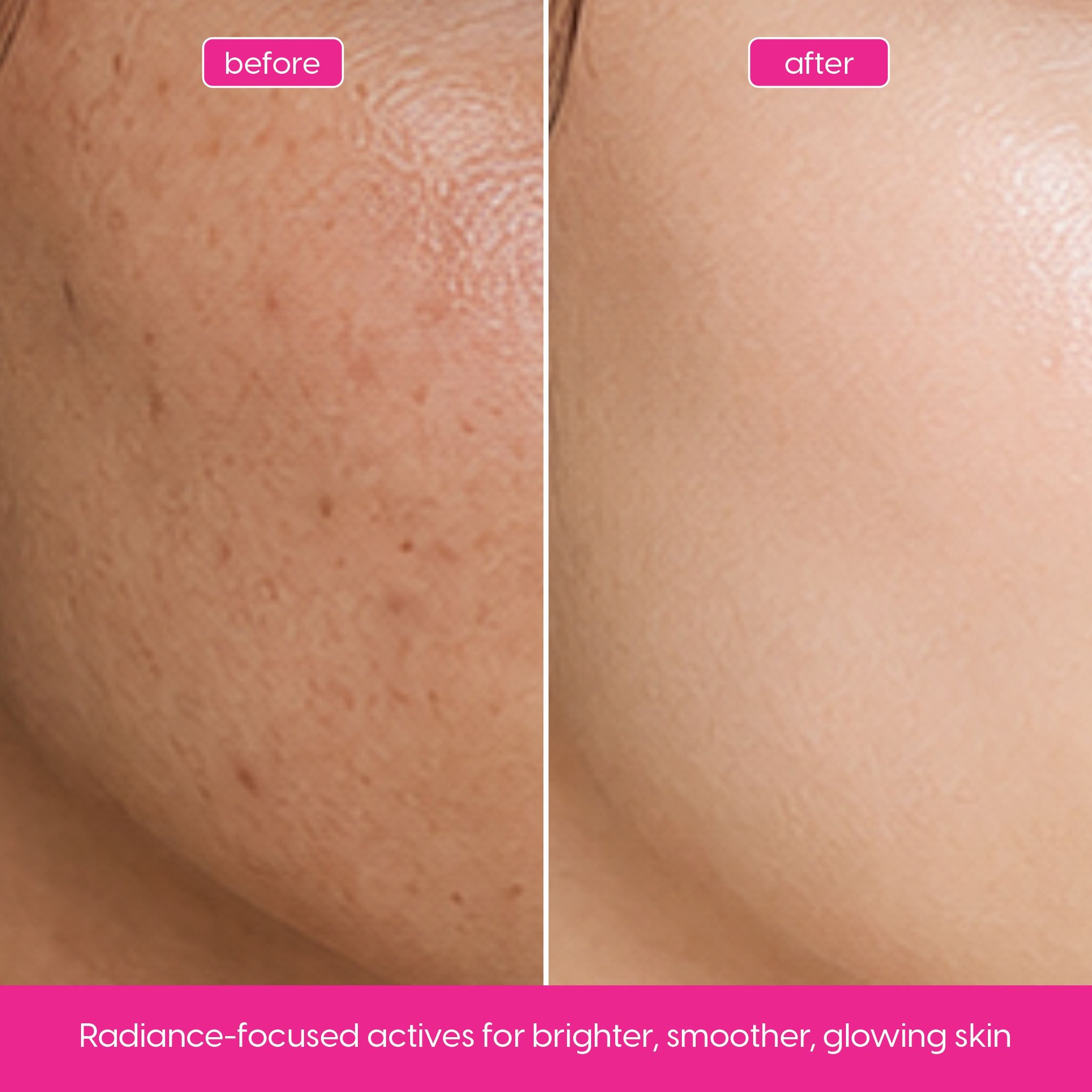 Radiant Glow Serum – Brightening & Hydrating for Dull, Uneven Skin