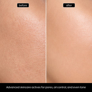 Niacinamide + Zinc Serum for Oil Control & Refined Pores