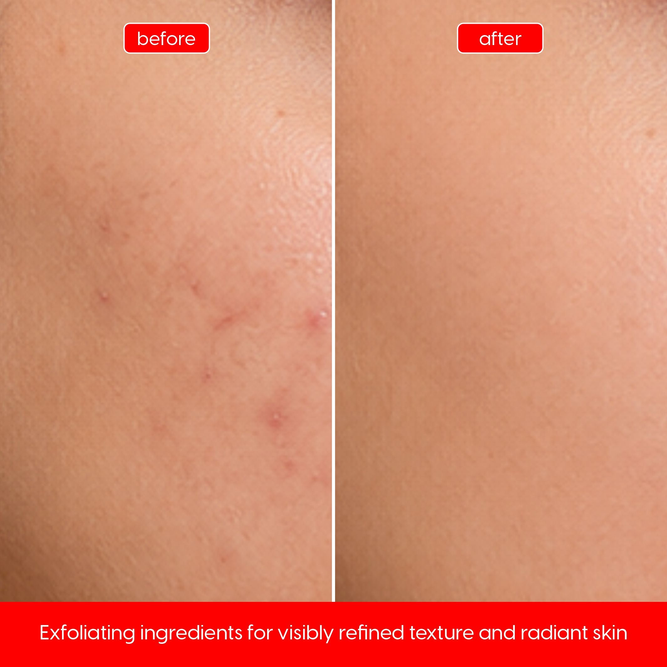 Glycolic Acid 10% Serum for Smooth, Bright, Even-Looking Skin