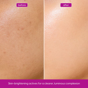 Glutathione Serum for Skin Brightening & a More Even Tone
