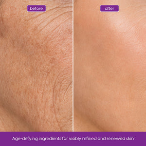 Retinol Serum with Niacinamide for Fine Lines & Smoother Skin